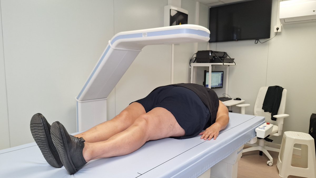 🆕 Arrenquem el primer gran estudi a Espanya per avaluar la prevalença d'obesitat sarcopènica en adults

💪 La obesitat greu pot acompanyar-se de sarcopènia, la pèrdua de massa i funció muscular. Tot i que és típica de la gent gran, pot afectar tothom

ℹ️ i.mtr.cool/jzoeihxnwt