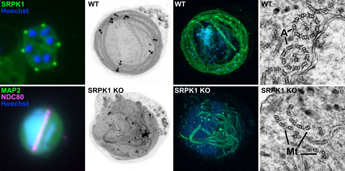 Ryuji Yanase (@ryujiyanase) on Twitter photo Pleased to share my first study on Plasmodium, showing how divergent kinases localising in distinct compartments drive MTOC, kinetochore, and axoneme organisation in male gametogenesis. Huge thanks to <a href="/RitaTewari/">Rita Tewari</a> <a href="/David_Guttery/">David Guttery</a> <a href="/Zeeshan_MF/">Zeeshan</a>, and the team.
biorxiv.org/content/10.110… Pleased to share my first study on Plasmodium, showing how divergent kinases localising in distinct compartments drive MTOC, kinetochore, and axoneme organisation in male gametogenesis. Huge thanks to <a href="/RitaTewari/">Rita Tewari</a> <a href="/David_Guttery/">David Guttery</a> <a href="/Zeeshan_MF/">Zeeshan</a>, and the team.
biorxiv.org/content/10.110…