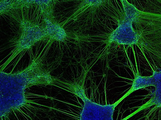A review of software tools in #neuroscience to reconstruct microscope images into neural system network models

📷 : Cassandra Hoffmann et al <a href="/MNC_Psychiatry/">Melbourne Neuropsychiatry Centre</a> in <a href="/CommsBio/">Communications Biology</a> 
➡️ : bpod.org.uk/archive/2024/9…