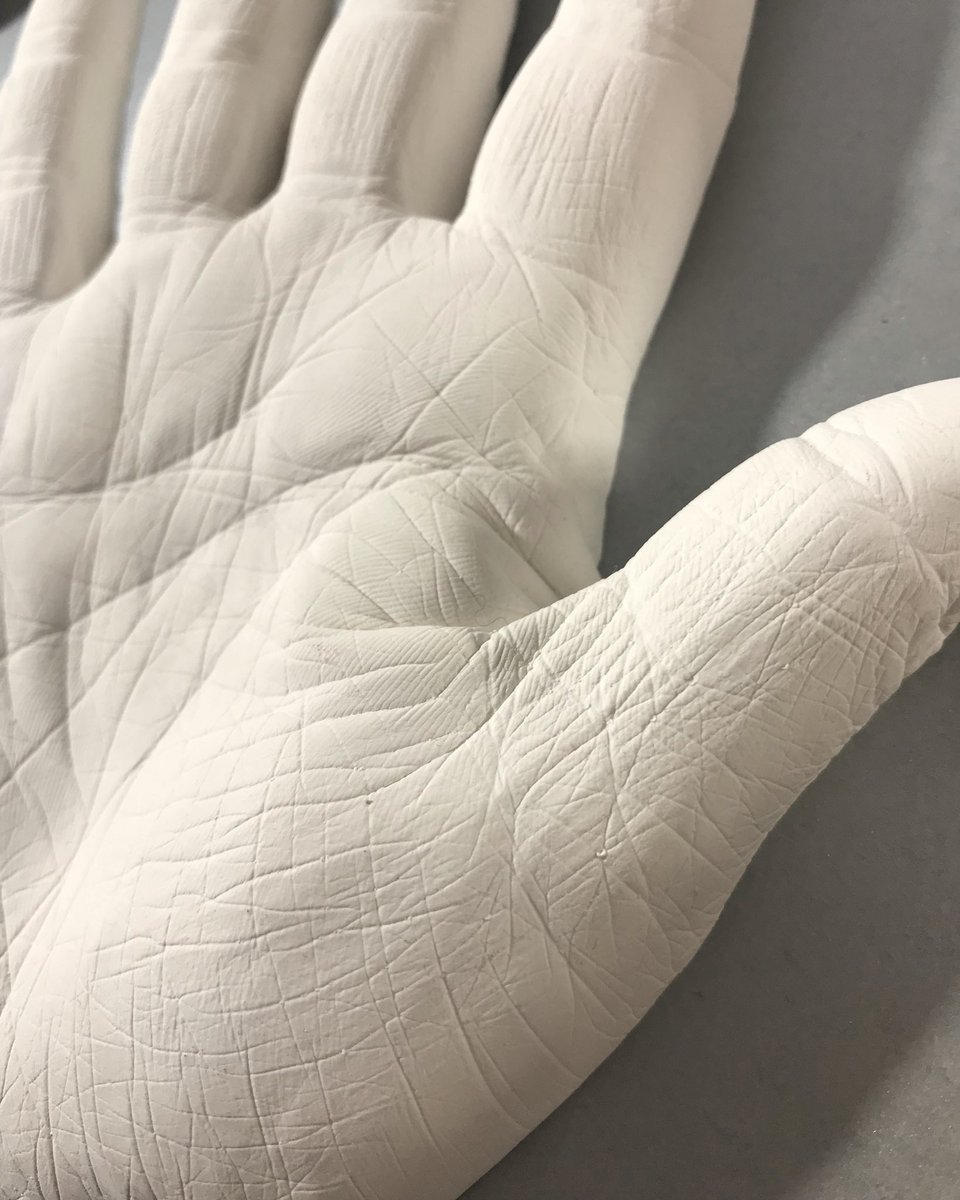 SRCastingstudio's tweet photo. It’s all about the fine details 😍

#handcast #finedetails #plasterhandcast https://t.co/ZDkQbkFYiZ
