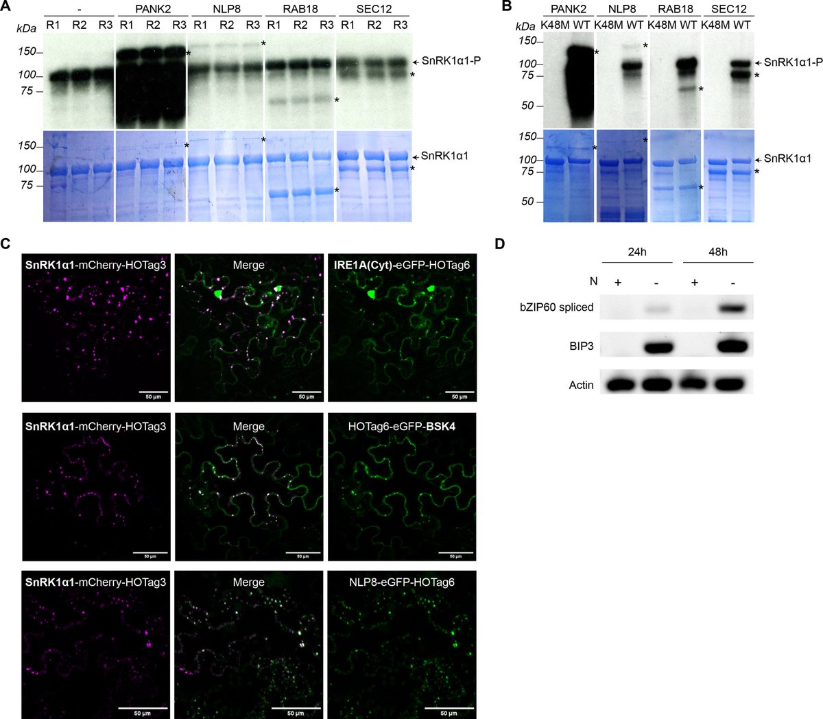 tk_ozawa's tweet photo. Amazing work🤯 by Persyn et al. (2024) on the #nitrogen-specific #interactome of #SnRK1 and #PlantTOR in #Arabidopsis by AP-MS and PL-MS, showing that some novel N-specific SnRK1 interactors (e.g. IRE1A and RAB18) are involved in #autophagy induction at the #EndoplasmicReticulum. https://t.co/lJvarW6f3E
