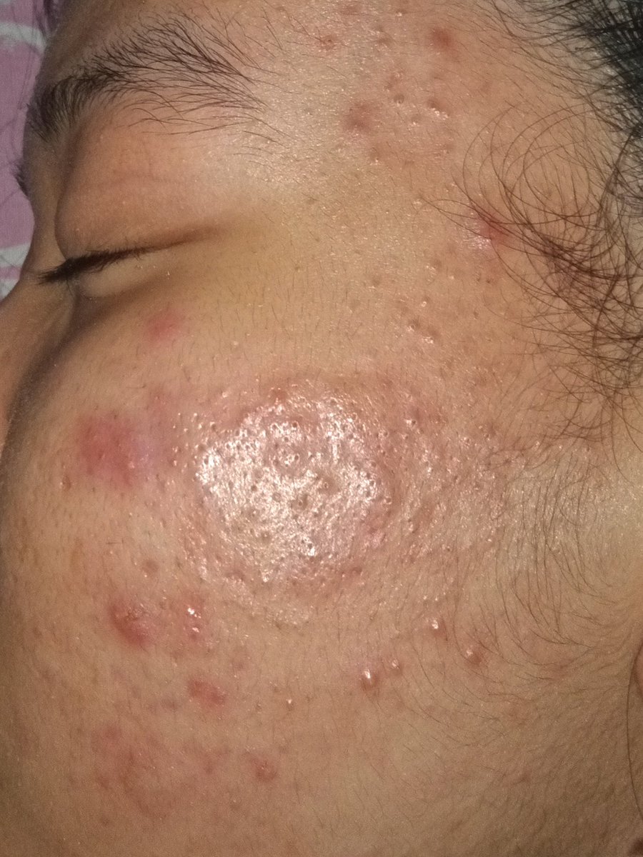 washitbola's tweet photo. meanwhile hasil dari skincare korea yg udah sustain itu🥹 ga akan ganti sampe dunia jadi onde-onde https://t.co/mQVoh1bbv7