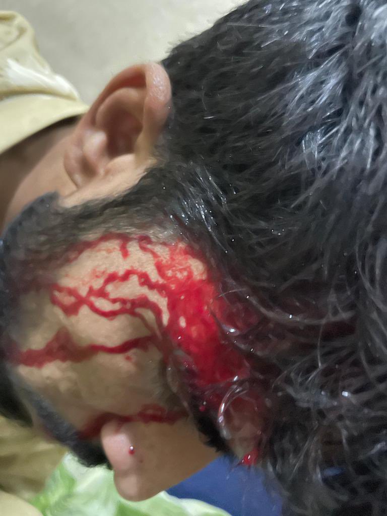 yaagibaloch18's tweet photo. We demand that our arrested students be released immediately. Profiling and violence against Baloch students must be stopped and security for students must be ensured on campus. #AttackonBalochstudents #punjabuniversity #SaveBalochStudents
#StopProfilingBalochStudents https://t.co/kVP0Sp47fq