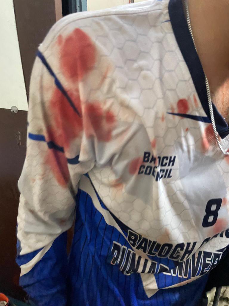 yaagibaloch18's tweet photo. We demand that our arrested students be released immediately. Profiling and violence against Baloch students must be stopped and security for students must be ensured on campus. #AttackonBalochstudents #punjabuniversity #SaveBalochStudents
#StopProfilingBalochStudents https://t.co/kVP0Sp47fq