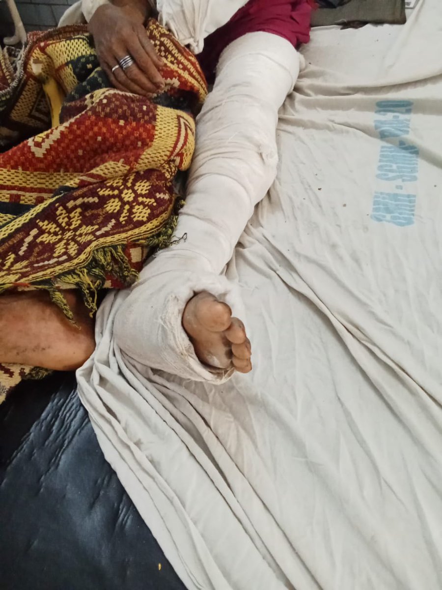 Mp के जिला रीवा में मजदूर कलावती यादव ने अतुल द्विवेदी के खेत में काम करने से इनकार किया तो अतुल द्विवेदी ने कलावती यादव के हाथ पैर तोड़ दिया बाद में जब पीड़िता थाने में रिपोर्ट लिखाने गए तो रिपोर्ट नहीं लिखी ओबीसी महासभा के संज्ञान में आकर थाने में पीड़िता की FiR लिखाई ! <a href="/ANI/">ANI</a>