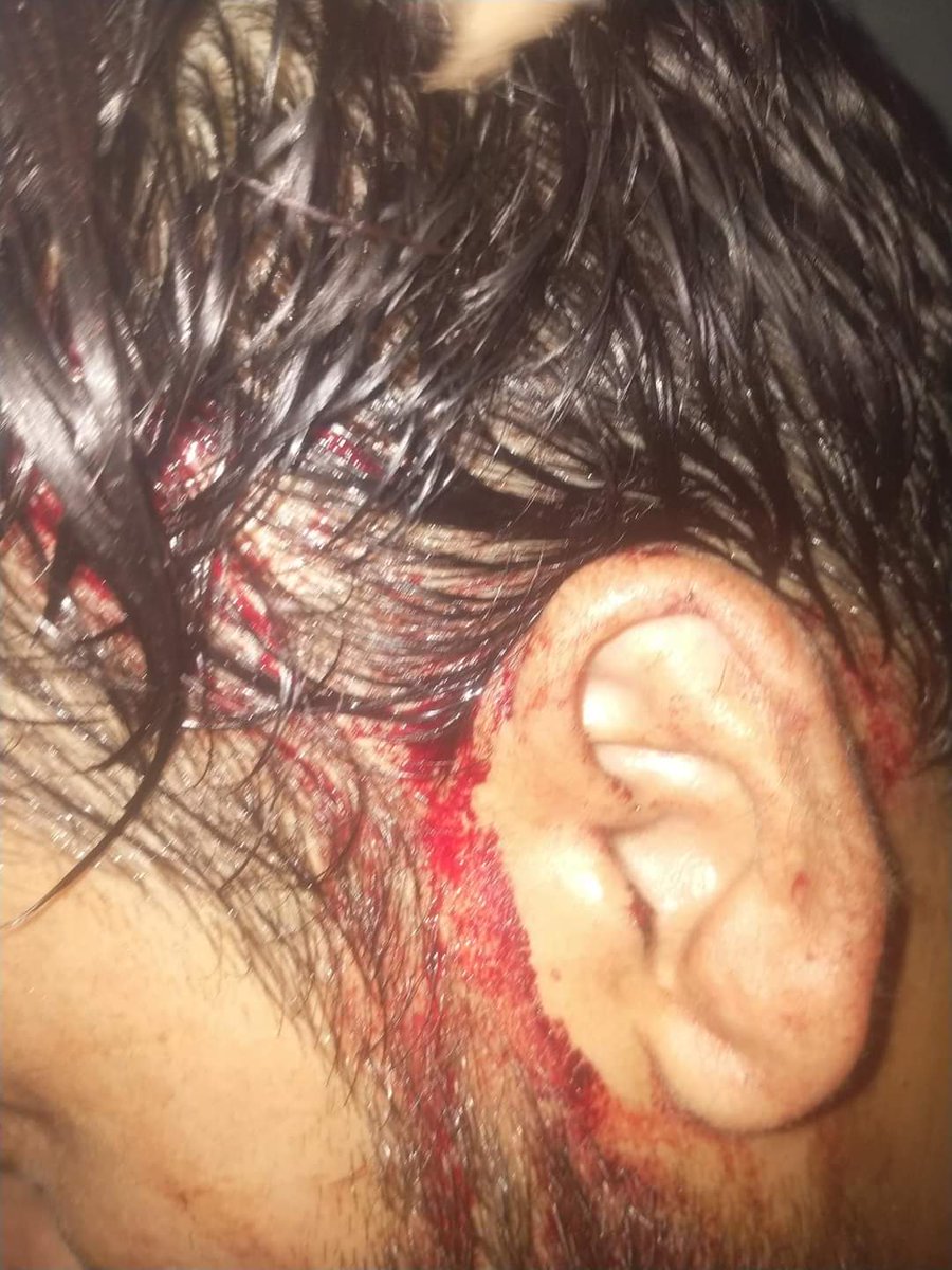 Alijanmaqsood12's tweet photo. Oppressions on Baloch students in Lahore continue. Yet again, Jamiat students beat unarmed Baloch students with the back up of the Punjab University security in Boys Hostel. The tactics to deprive Baloch students from studies are prolonging with direct involvement of the varsity. https://t.co/Vpprri0Viz