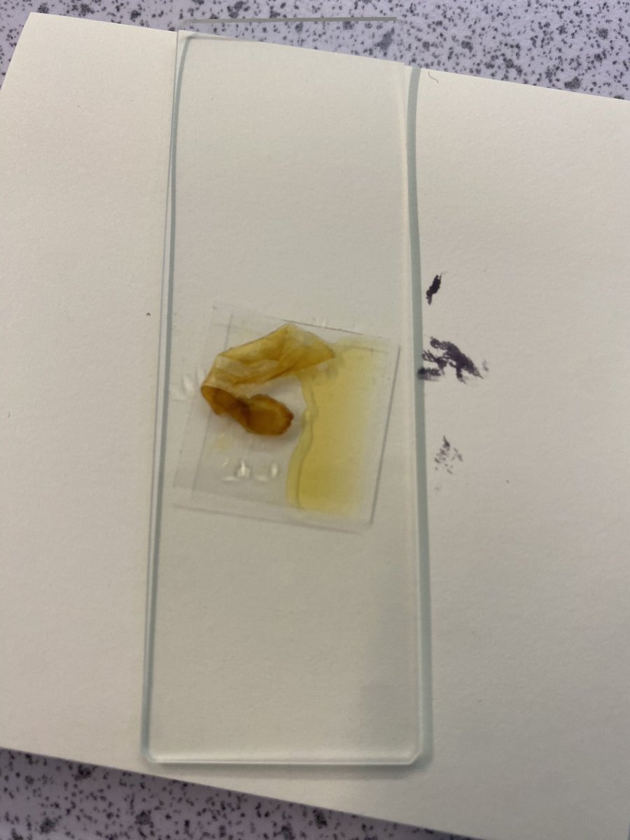 CharlotteAmyJen's tweet photo. Y9 Cell Biology- making onion and banana slides. So impressed with their skills! I still find taking microscope photos quite tricky!🔬@chatbiology #gcsebiology https://t.co/tNCRwdB6UQ