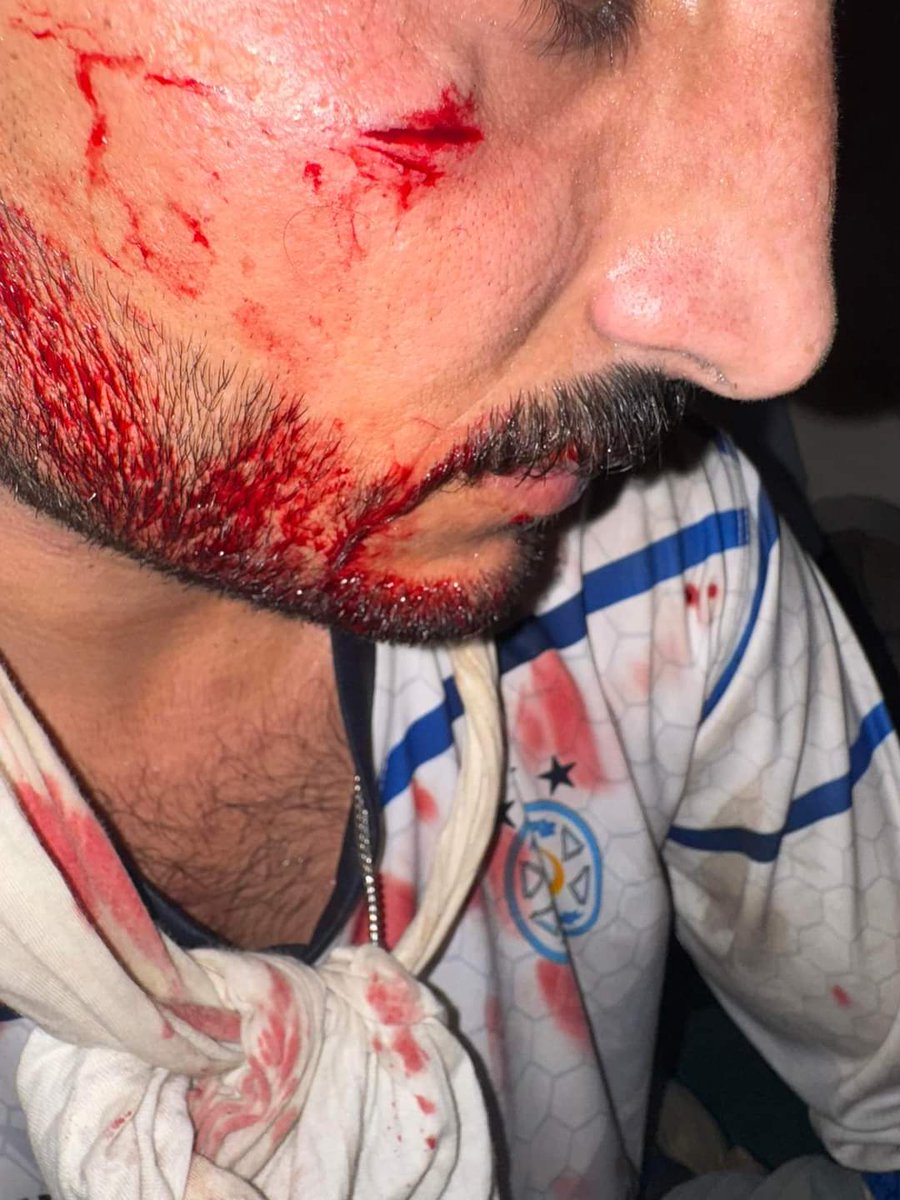 Alijanmaqsood12's tweet photo. Today, Jamiat students beat Baloch students in Boys Hostel 8 in Punjab University with the support of the security of the varsity. And then the police came and arrested 11 Baloch students. This is a very straight message from Punjab of its long-existing policy towards the Baloch. https://t.co/GvYeaROoRT