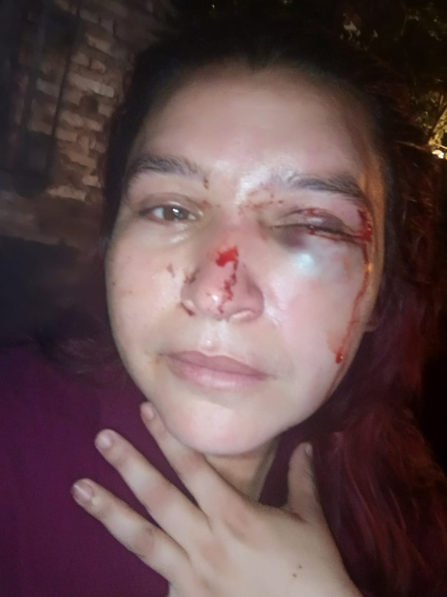 Comunicado

Denunciamos el violento ataque físico que recibió Kimberly Samaniego, miembro de la dirección de la Juventud Comunista y dirigente territorial, por llevar a cabo una denuncia en un caso de violencia.