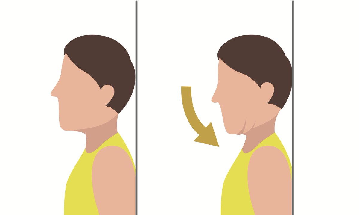 One of my most effective exercises for helping tech neck is a chin tuck. It's simple! Look straight ahead. Gently glide your chin straight back. It’s a small movement; don’t take your head up and down or bend your neck forward. Hold for 5 seconds, then relax. #chintuck #teckneck