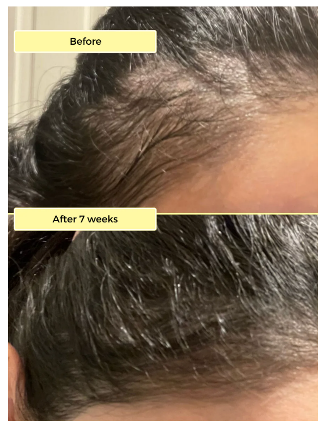 INTOUCH_RUGBY's tweet photo. Say Goodbye to dry, thinning and lifeless hair. THE MAGIC SOLUTION IS HERE. https://t.co/myIfMxKy9A ... now live @ https://t.co/lWoL74xYp3 ! #saturdaysunshinebeauty #ad #magicsolution https://t.co/QadaNuXDPP