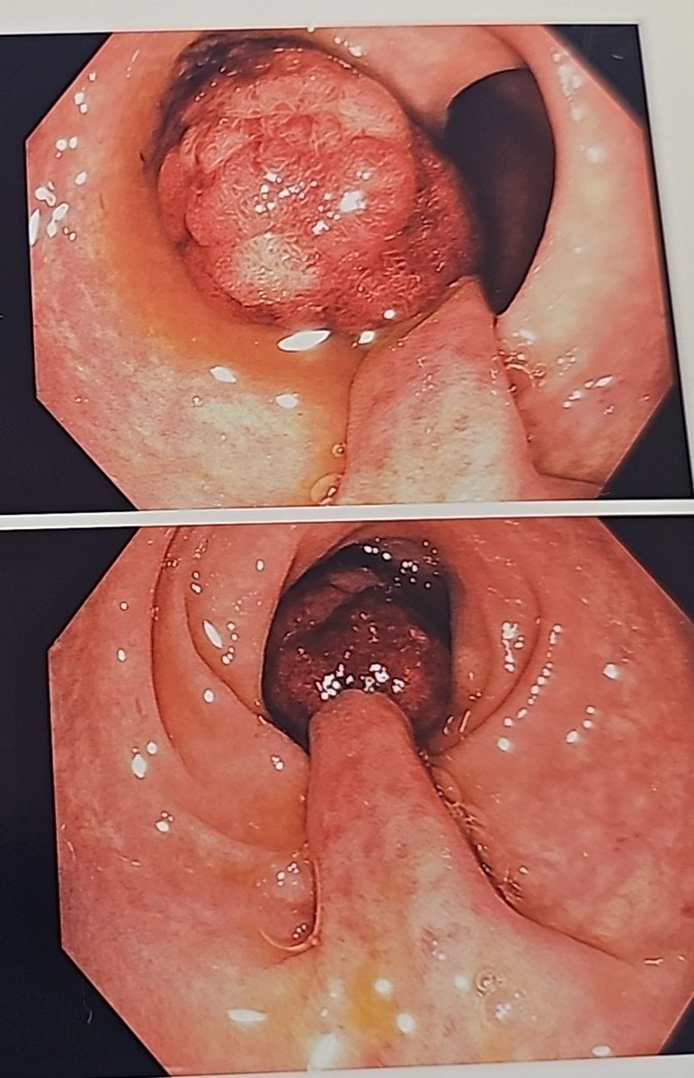 Turki AlAmri |تُرْكي عبدالله الْعَمريَّ MD tweet media