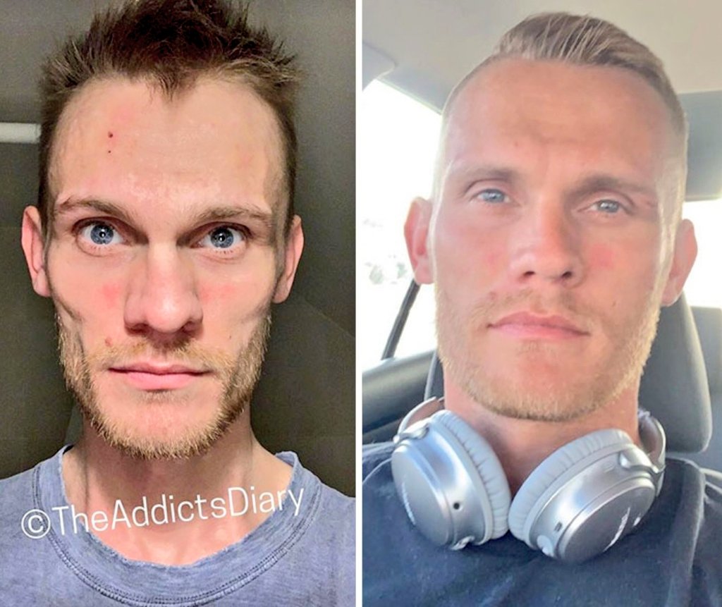 Beating Addiction.

Climbing back from Rock Bottom deserves endless praise.