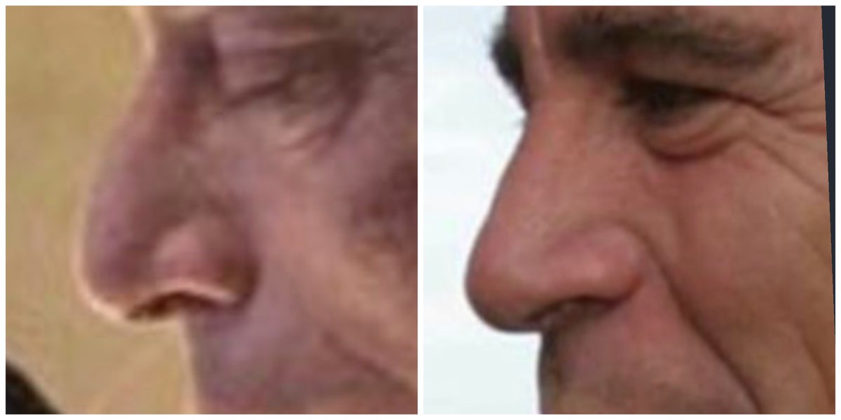 Ben Around tweet media