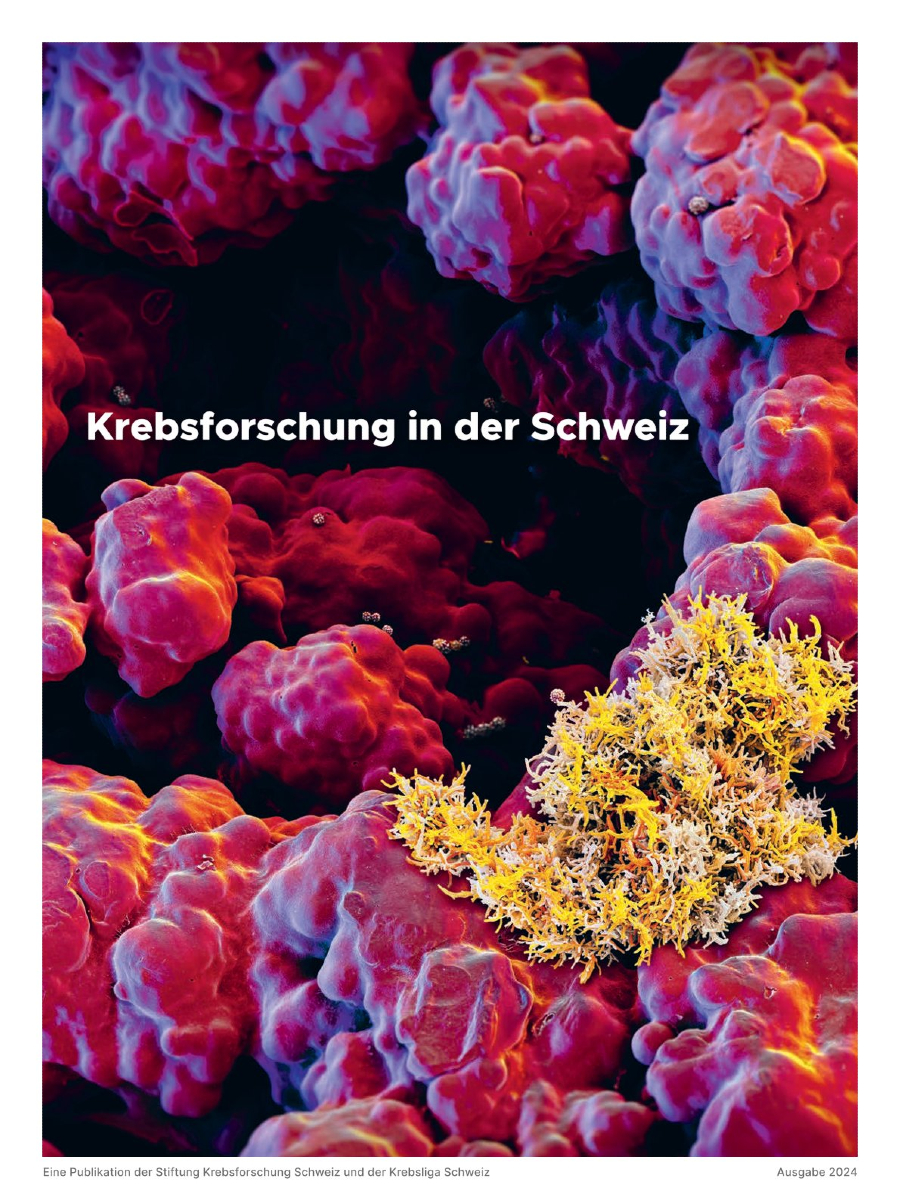 Heute ist #Weltkrebsforschungstag
Die #Krebsforschung und die #Krebsliga Schweiz erhalten jährlich rund 200 Forschungsprojekte. Bei der Prüfung dieser Gesuche kommt der unabhängigen Wisschenschaftlichen Kommission eine zentrale Rolle zu. 

➡ issuu.com/krebsliga/docs…

#WCRD