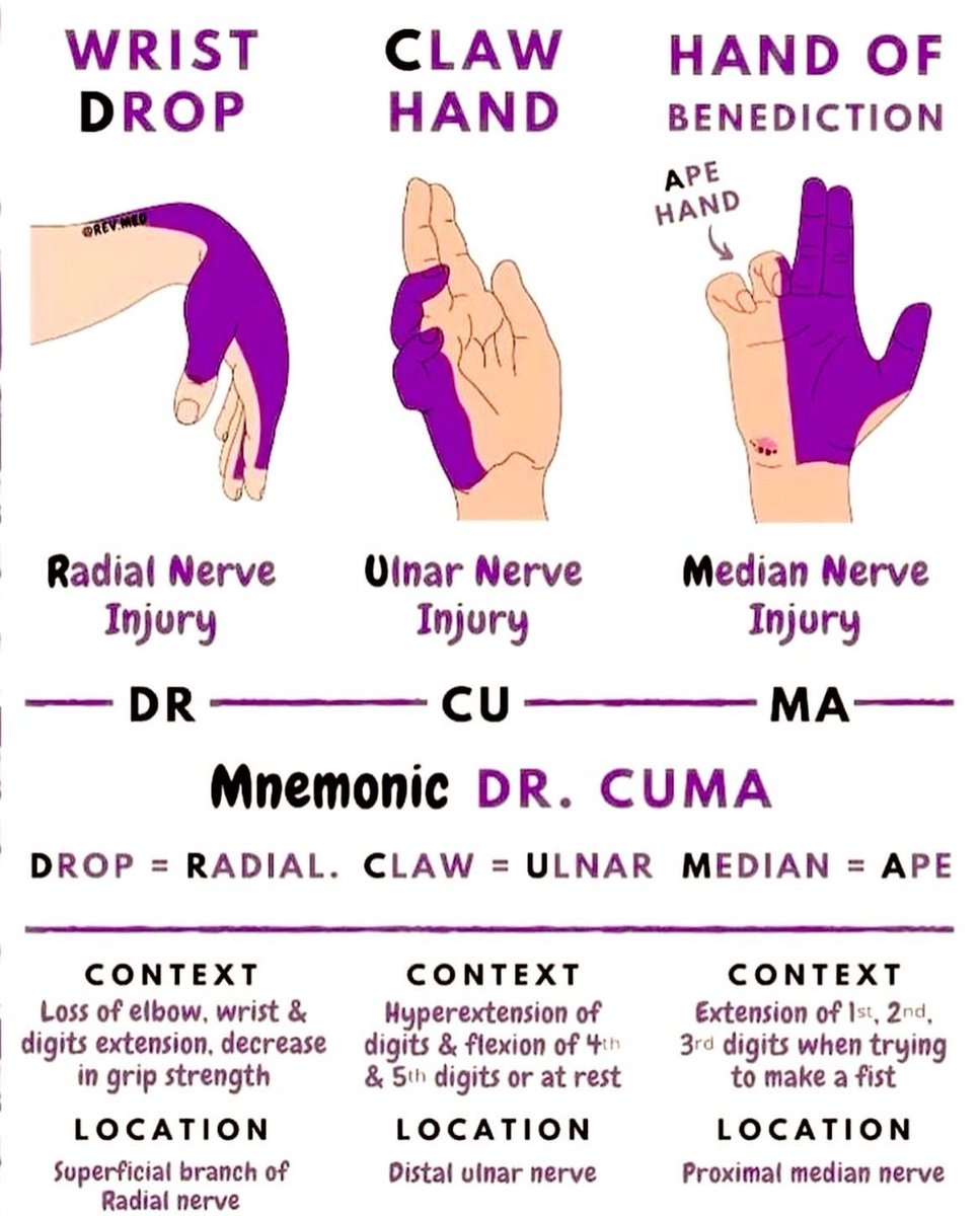 Doctors__squad's tweet photo. Nerve Injuries https://t.co/QnNgb24MbU