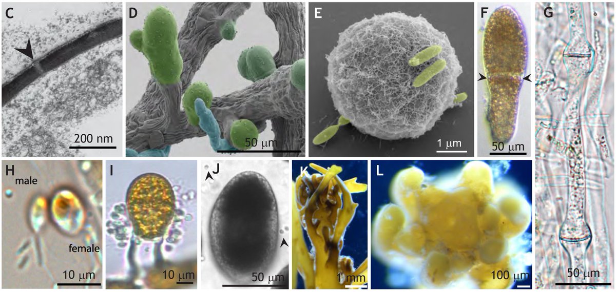 Insights into the molecular bases of multicellular development from brown algae

Read this #DevSIDiversity Review Article from Rita Batista, Liping Wang, Kenny Bogaert and Susana Coelho @MPI_Bio:

journals.biologists.com/dev/article/15…