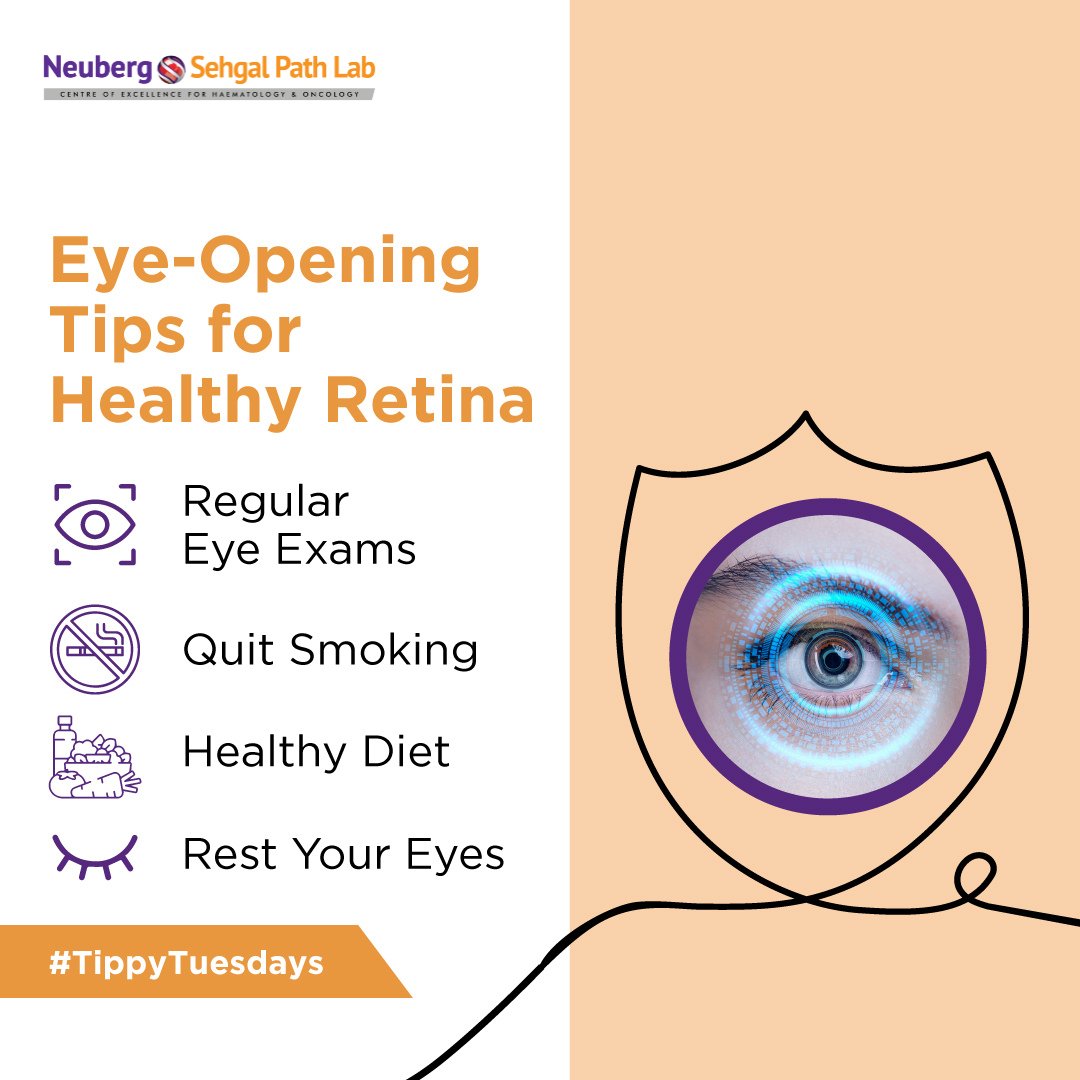 SehgalPathLab's tweet photo. Don’t take your eyes for granted. Take care of them today for a clearer tomorrow. Start with these simple habits to protect your retina and preserve your sight.
#EyeHealth #HealthyVision #TippyTuesday #PreventVisionLoss #ProtectYourVision #Neubergsehgalpathlab https://t.co/DPj4x5IXi3