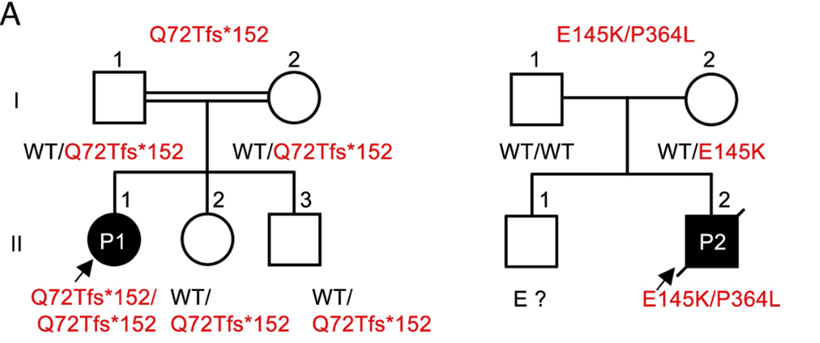 Anne Puel (@anne_puel) on Twitter photo <a href="/PNASNews/">PNASNews</a> 3/ We describe 2 patients with inherited RelB deficiency, presenting with a wide range of infectious diseases (bacterial, viral, fungal). This T and B cell deficiency is characterized by reduced blood counts of naïve T cells and memory B cells, and low in vitro IgG/IgA production <a href="/PNASNews/">PNASNews</a> 3/ We describe 2 patients with inherited RelB deficiency, presenting with a wide range of infectious diseases (bacterial, viral, fungal). This T and B cell deficiency is characterized by reduced blood counts of naïve T cells and memory B cells, and low in vitro IgG/IgA production