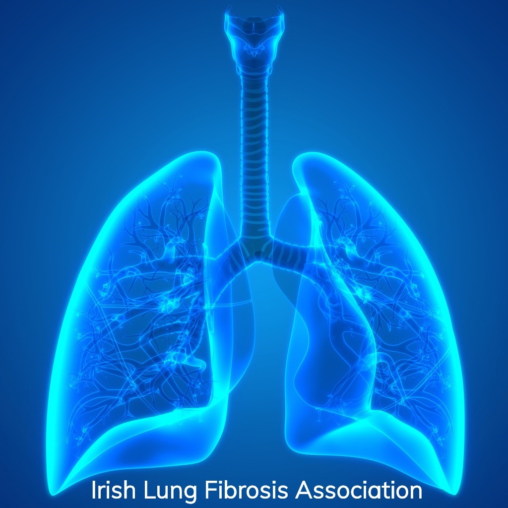 ILFA_Ireland's tweet photo. 25th September is #WorldLungDay and September is #pulmonaryfibrosisawareness month. Pulmonary fibrosis (lung fibrosis) is a serious, life-limiting condition. Visit https://t.co/LMdpaKztc7 to learn more about pulmonary fibrosis and @ILFA_Ireland's work supporting patients https://t.co/ZttlPQBiMJ
