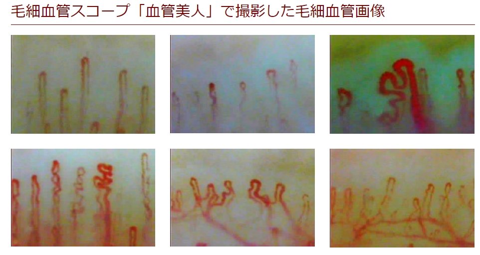 ほぼ新品 毛細血管スコープ 血管美人 SC-10 マニュアル一式 【公式通販】