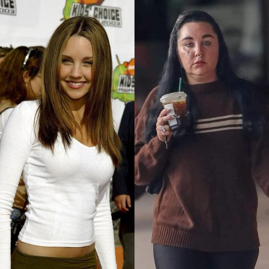 ianmiles's tweet image. Someone needs to do a study on what happened to Amanda Bynes.