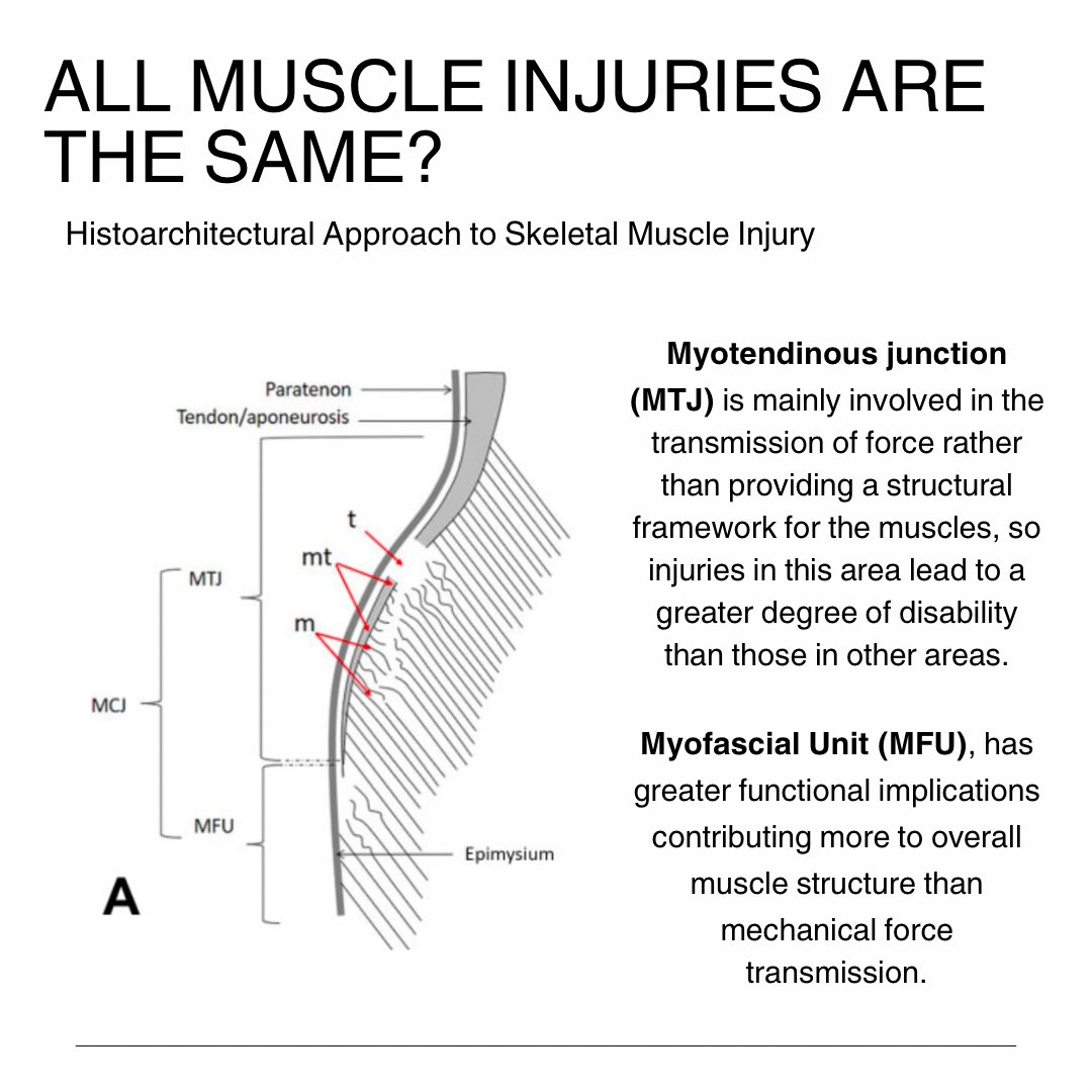 André Mendes (@agmendes_physio) on Twitter photo Why do some injuries tend to develop differently?
During my experience with this type of injury, I've often had cases where the injury seemed more serious and the progression seemed to be different from what I expected.
My research led me to the studies of <a href="/carlespedret/">carlespedret</a> . The Why do some injuries tend to develop differently?
During my experience with this type of injury, I've often had cases where the injury seemed more serious and the progression seemed to be different from what I expected.
My research led me to the studies of <a href="/carlespedret/">carlespedret</a> . The