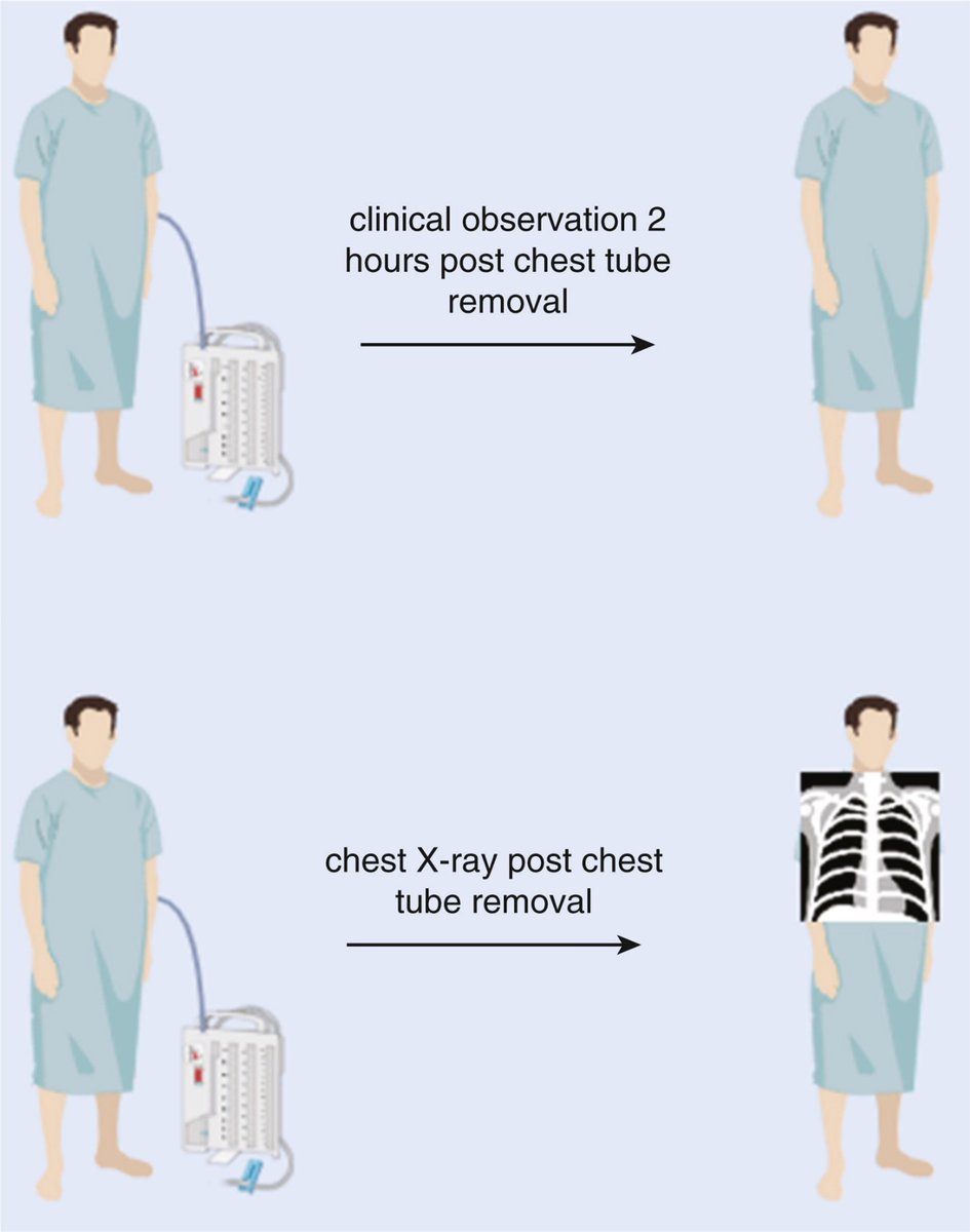 Researchers at <a href="/UofTSurgery/">U of T Department of Surgery</a> found that clinical observation can safely replace routine chest radiographs after chest tube removal in asymptomatic patients undergoing elective #thoracic surgery. Read the single-center prospective study in #JTCVS Open: doi.org/10.1016/j.xjon…