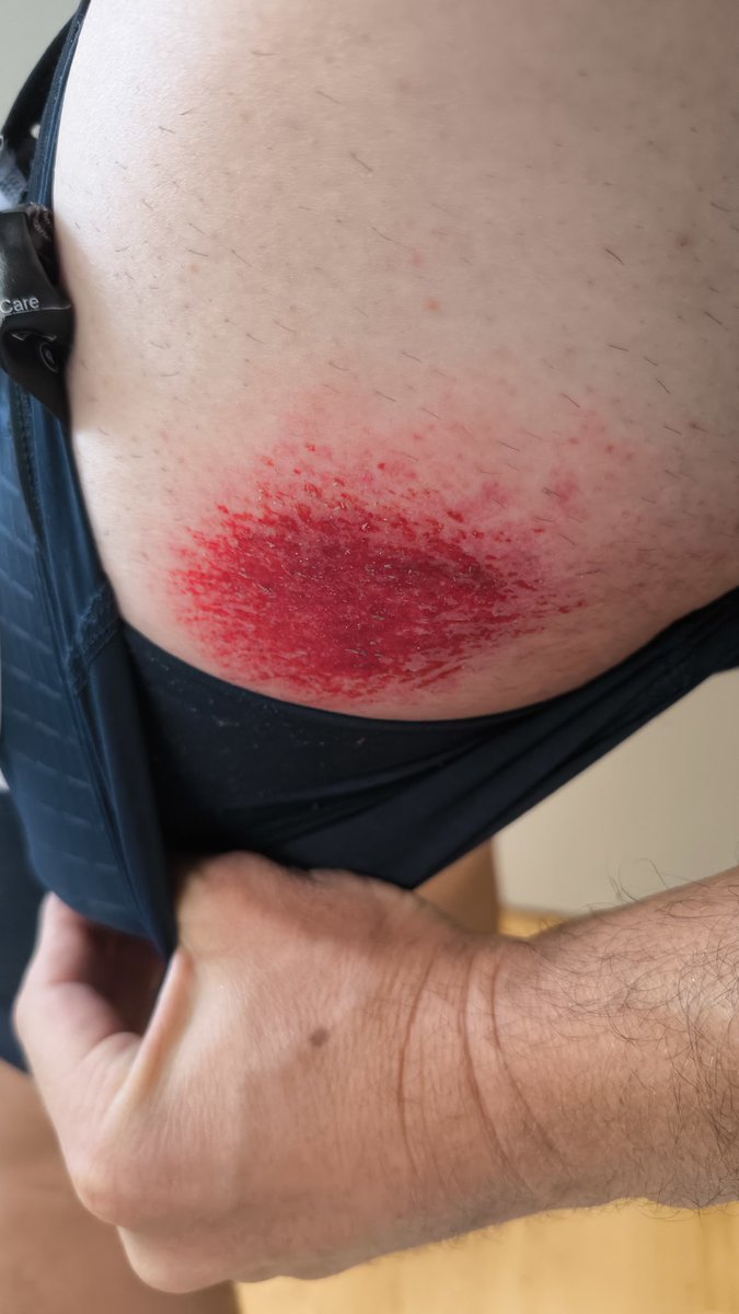 Matos Vélo 🚲 tweet media