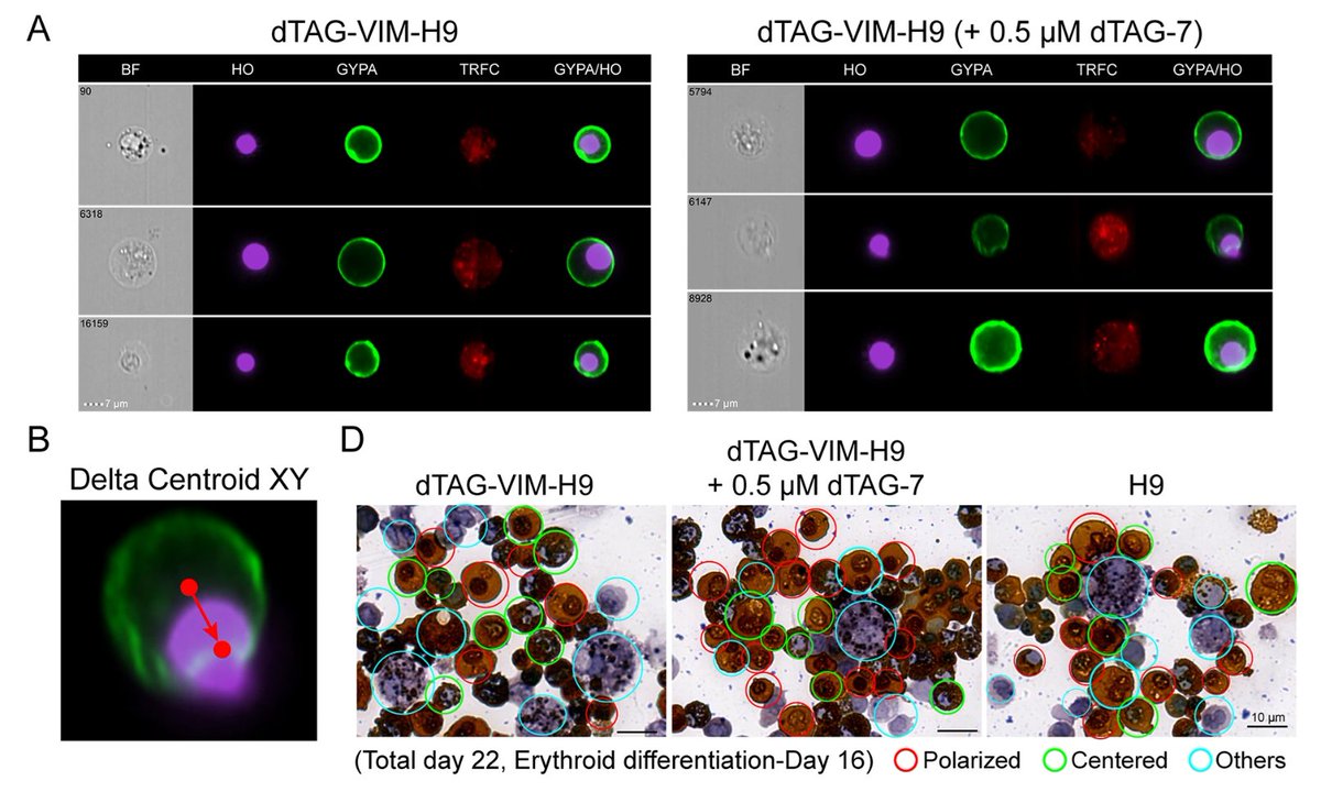 ESC_iPSC_News's tweet photo. Vimentin expression diminished during normal erythropoiesis in CD34+ cord blood cells, whereas it persisted in #erythroid cells differentiated from human ESCs, reports a Beijing Institute of Radiation Medicine team. 

🔓 https://t.co/oDYbhrxbCU https://t.co/if63ImI0q2