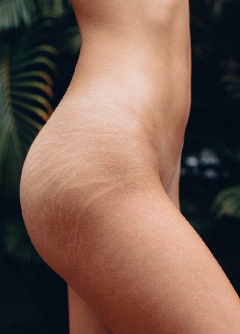 "Bello atardecer en braille"

#nosotras