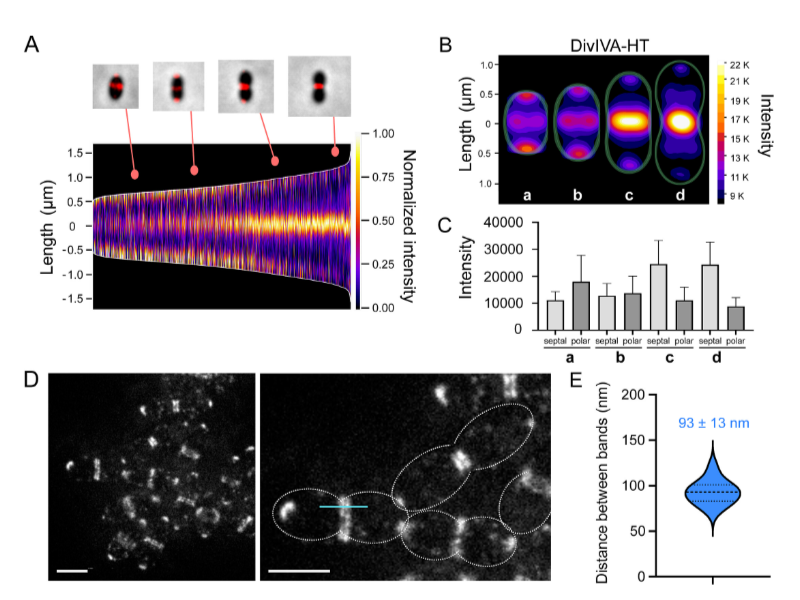 ASMicrobiology's tweet photo. What does DivIVA do? New research in @mbiojournal reveals that, in Streptococcus pneumoniae, this structural protein is a key player in the orchestration of cell division and elongation. Get the details, including how scientists think DivIVA works, here: https://t.co/HjEll6BKWS https://t.co/upGE2OCuq8