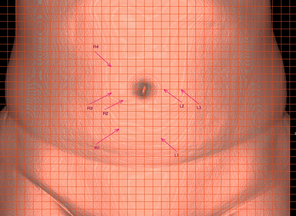 Journal Ultrasound tweet media
