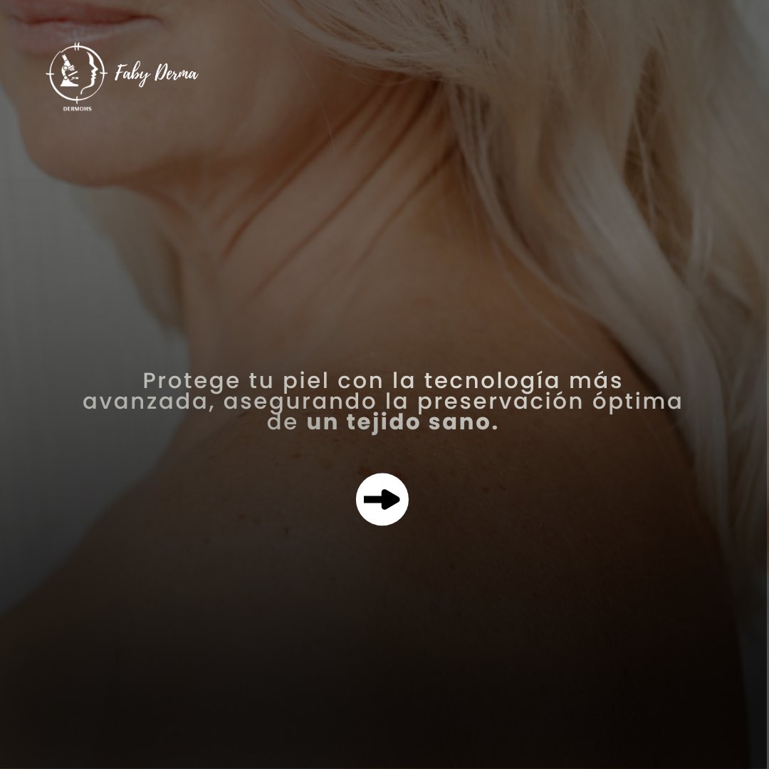 fabyderma's tweet photo. Somos la ÚNICA clínica dermatológica en el país que ofrece la Cirugía de Mohs para eliminar el cáncer de piel? 🩺✨
En DERMOHS contamos con más experiencia y estudios como La Universidad de Harvard. #Dermohs #CirugíaDeMohs #Salud #PrevenciónCáncerDePiel #FabyDerma https://t.co/ghW3EMkRWV