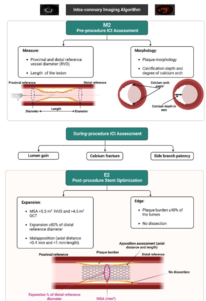 j-saudi-heart.com/jsha/vol36/iss… <a href="/TheSaudiHeart/">جمعية القلب السعودية</a> 

E2M2 is ours

What is your algorithm ❓

<a href="/MogneeA/">Mognee Alameer</a> <a href="/Alshehri_MD/">Ahmed AlShehri MD د.أحمد الشهري</a> <a href="/HindAlosaimi_/">Hind Alosaimi</a> <a href="/Zayer_h/">Hussain Alzayer | حسين الزاير</a> <a href="/AlkashkariWail/">Wail AlkashkariFSCAI,FPICSوائل القشقرى🇸🇦🇨🇦🇺🇲</a> <a href="/AdelTash/">Adel Tash</a>