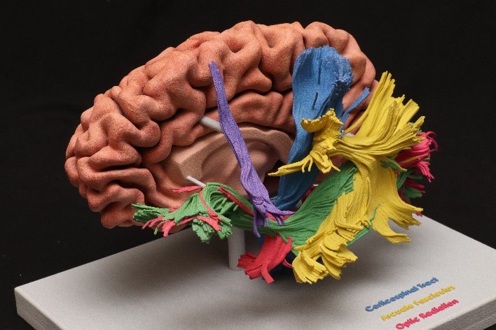 MayoRadiology's tweet photo. Jack Black was one of the #AnatomicModelingUnit interns at #MayoClinicMN. He is majoring in neurobiology at the @UWMadison. Jack’s favorite project this summer was making 3D-printed white-matter tractography models to demonstrate anatomical features and visual field defects. https://t.co/pivA9QV5px