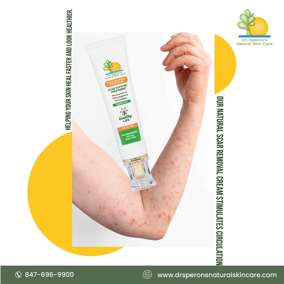 prplastic's tweet photo. 🛒 https://t.co/wIIuMcHgDA

#scartreatment #scarcare #SkincareCommunity #skincarescience #skincaretips #tiktokskincare #ScarSupport #HealthySkin #healthyskin #HealthySkinJourney #healthyskingoals #skincare #skincareproducts #topratedproduct #onlineshopping #LowestPriceGuaranteed https://t.co/BAfLf8H3WT