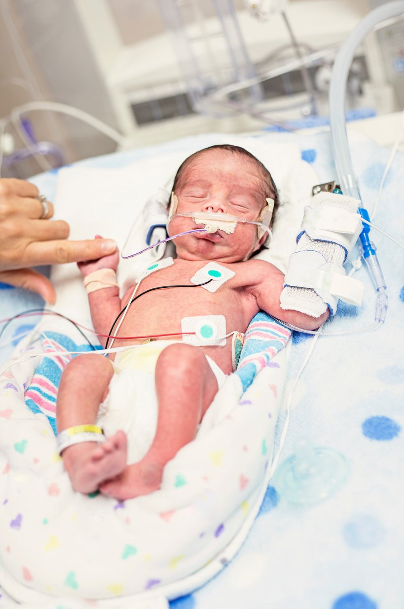 A research team led by <a href="/StanfordChild/">Stanford Children's</a> has developed a simple blood test for pregnant women that shows, with 75-80% accuracy, which pregnancies will end in premature birth. 👣 Hear how the team's efforts are helping women have healthier pregnancies. ❤️  loom.ly/8FP9UTw