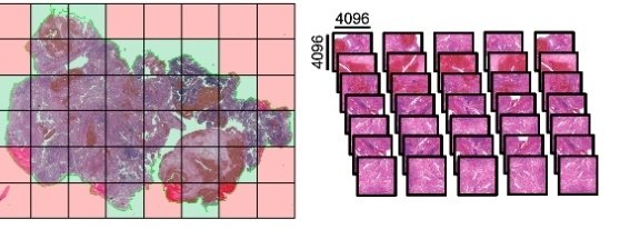 Wer Lust auf eine tolle Stadt, ein nettes Team und spannende neuroonkologische Forschung hat (Fokus digitale Pathologie) - Ich habe eine Arztstelle für 3 Jahre bei ins in der Neuropathologie in Hamburg zu vergeben! Meldet euch gerne bei Interesse für weitere Informationen bei mir