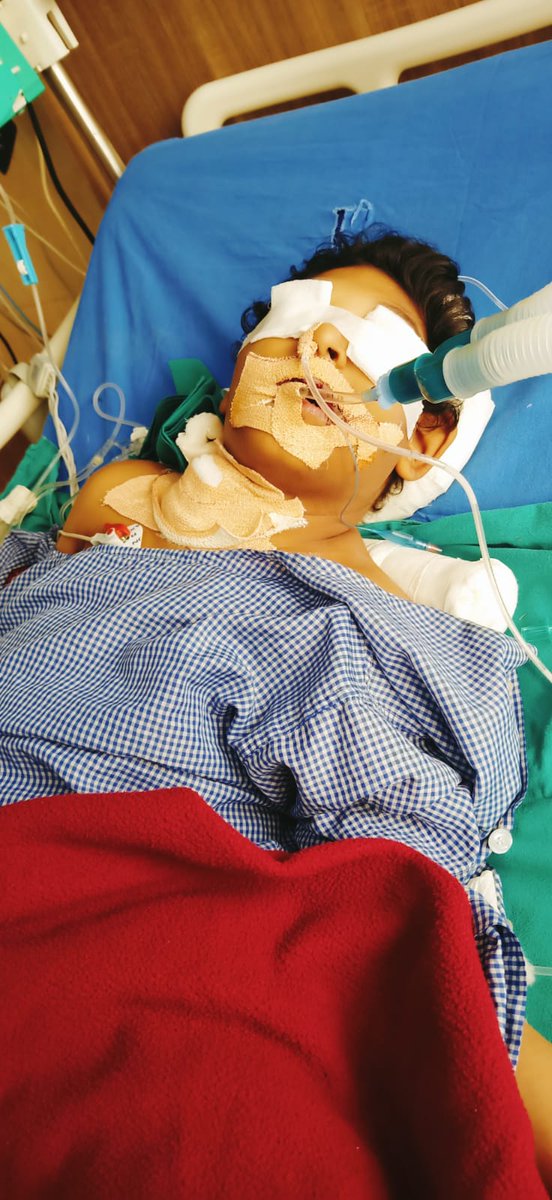 नवी मुंबई के ओला ड्राइवर सतीश कुमार त्रिपाठी के बेटे उम्र - 6साल,आयान सतीश त्रिपाठी को फेफडो का संक्रमण हुवा है. एक महिनेसे ओ हॉस्पिटल मैं जुन्ज रहे है.हॉस्पिटल का बिल बडते जा रहा है. #ngo #pmo #ola #uber #Help_For_Humanity #india  #driver