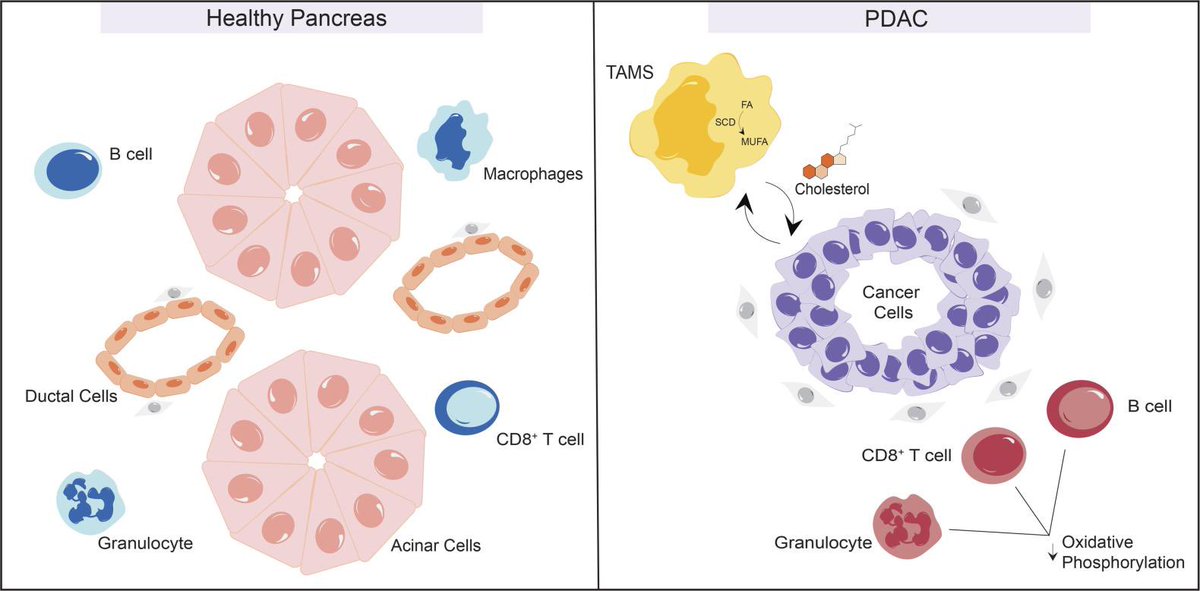Anirban Maitra (@aiims1742) on Twitter photo Metabolic landscape of the healthy pancreas and pancreatic tumor microenvironment
insight.jci.org/articles/view/…
<a href="/JCI_insight/">JCI insight</a> by <a href="/Pasca_Lab/">PascaLab</a> <a href="/LyssiotisLab/">Lyssiotis Lab</a> @radykm
Using scRNA seq data from organ donor pancreas & #PancreaticCancer, <a href="/UMICHpancreas/">Rogel and Blondy Center for Pancreatic Cancer</a> team figured out that cancer cells need Metabolic landscape of the healthy pancreas and pancreatic tumor microenvironment
insight.jci.org/articles/view/…
<a href="/JCI_insight/">JCI insight</a> by <a href="/Pasca_Lab/">PascaLab</a> <a href="/LyssiotisLab/">Lyssiotis Lab</a> @radykm
Using scRNA seq data from organ donor pancreas & #PancreaticCancer, <a href="/UMICHpancreas/">Rogel and Blondy Center for Pancreatic Cancer</a> team figured out that cancer cells need