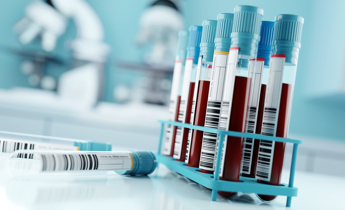 Alzheimer's Drug Discovery Foundation (@theaddf) on Twitter photo Announcing a new DxA investment in <a href="/C2NDiagnostics/">C2N Diagnostics</a> for over $7M—its largest investment to-date. This underscores the DxA’s commitment to developing & deploying #novel biomarkers—like #BloodTests—to transform the #Alzheimers diagnostic landscape: bit.ly/3TGx8yu Announcing a new DxA investment in <a href="/C2NDiagnostics/">C2N Diagnostics</a> for over $7M—its largest investment to-date. This underscores the DxA’s commitment to developing & deploying #novel biomarkers—like #BloodTests—to transform the #Alzheimers diagnostic landscape: bit.ly/3TGx8yu