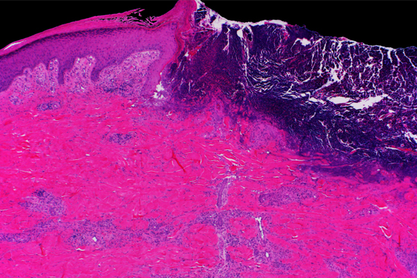 Learn the latest diagnostic and treatment strategies for comprehensive wound management at our upcoming CME conference. Mayo Clinic Wound Symposium is February 26-28, 2025, in Minnesota and via livestream. mayocl.in/4eFgZ4B