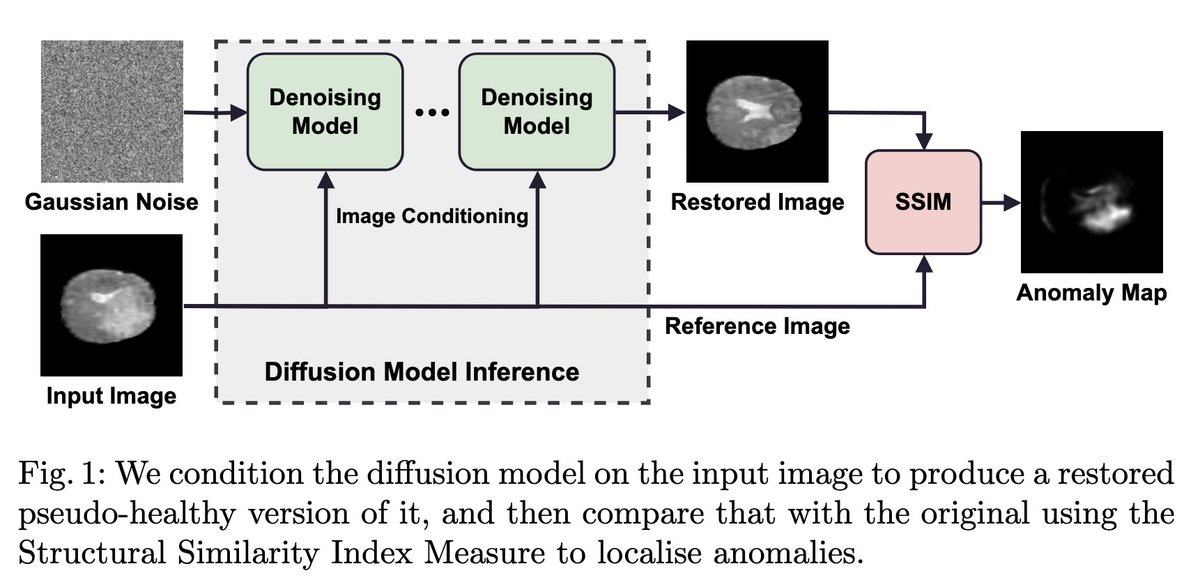 UNSURE workshop (@unsure_workshop) on Twitter photo #2: Image-Conditioned Diffusion models for Medical anomaly detection by <a href="/MertBTwit/">Matthew Baugh</a>, <a href="/BernhardKainz1/">Bernhard Kainz</a> et al. #MICCAI2024
📜: openreview.net/forum?id=fMQ9M…
📽️: youtu.be/iINT-ikKyvY?fe… #2: Image-Conditioned Diffusion models for Medical anomaly detection by <a href="/MertBTwit/">Matthew Baugh</a>, <a href="/BernhardKainz1/">Bernhard Kainz</a> et al. #MICCAI2024
📜: openreview.net/forum?id=fMQ9M…
📽️: youtu.be/iINT-ikKyvY?fe…