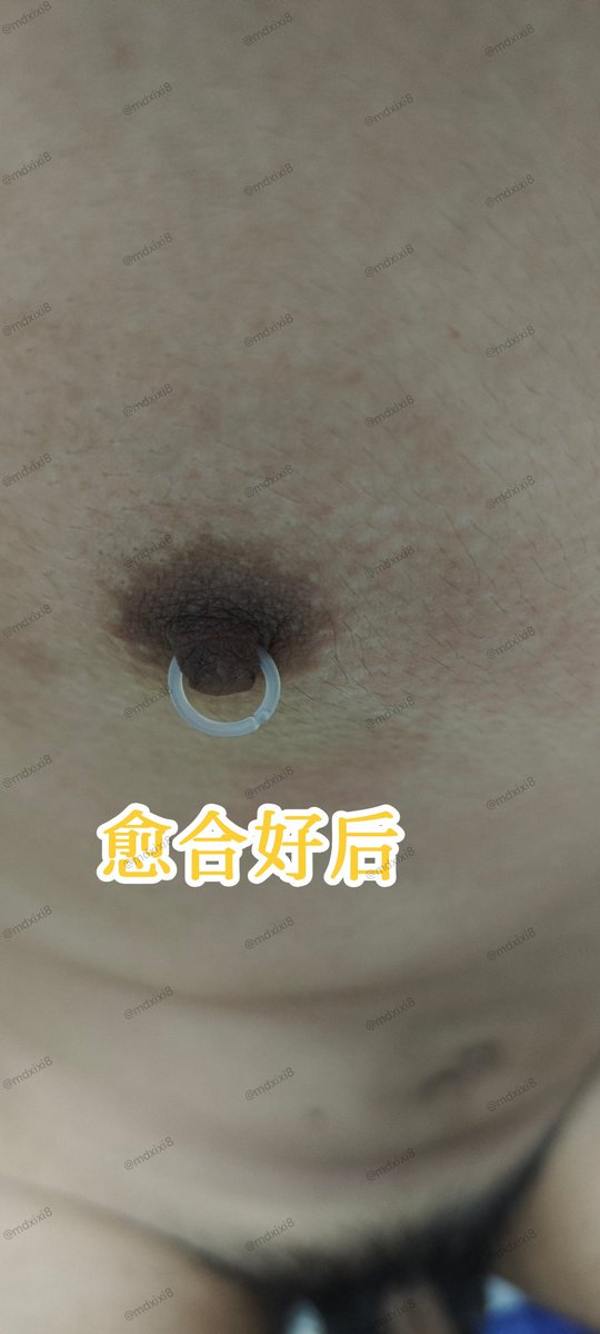 无痛穿孔教学 tweet media