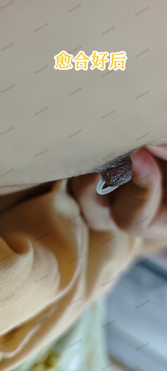 无痛穿孔教学 tweet media