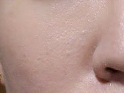 sappipii's tweet photo. 10일만에 모공이 어떻게 줄어듦;;
??? : 이게 되네.. 타래 ㄱㄱ https://t.co/i4sCLPrLqq