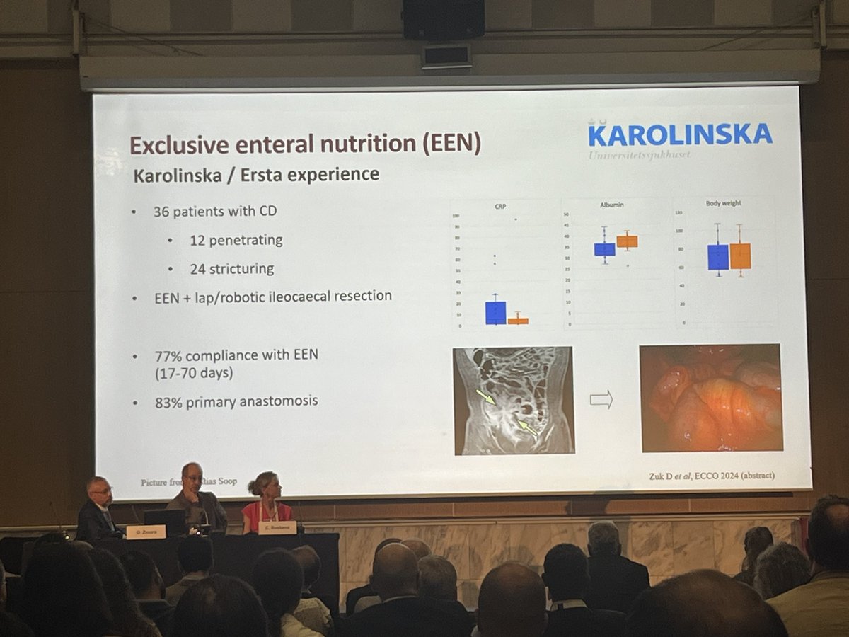 Lisa Massey (@lisahmassey) on Twitter photo Caroline Nordenvall sharing <a href="/karolinskainst/">Karolinska Institutet</a> experience of preparative optimisation with EEN for Crohn’s disease leading to improved patient outcomes <a href="/escp_tweets/">European Society of Coloproctology</a> Caroline Nordenvall sharing <a href="/karolinskainst/">Karolinska Institutet</a> experience of preparative optimisation with EEN for Crohn’s disease leading to improved patient outcomes <a href="/escp_tweets/">European Society of Coloproctology</a>