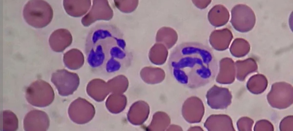 sjcrmain's tweet image. Impressive concentration at our Prep STEM Club last night! Look at these amazing white blood cell drawings under the microscope! 🧬✨ 

#STEMKids #FutureScientists #MicroscopyMagic #LearningThroughPlay