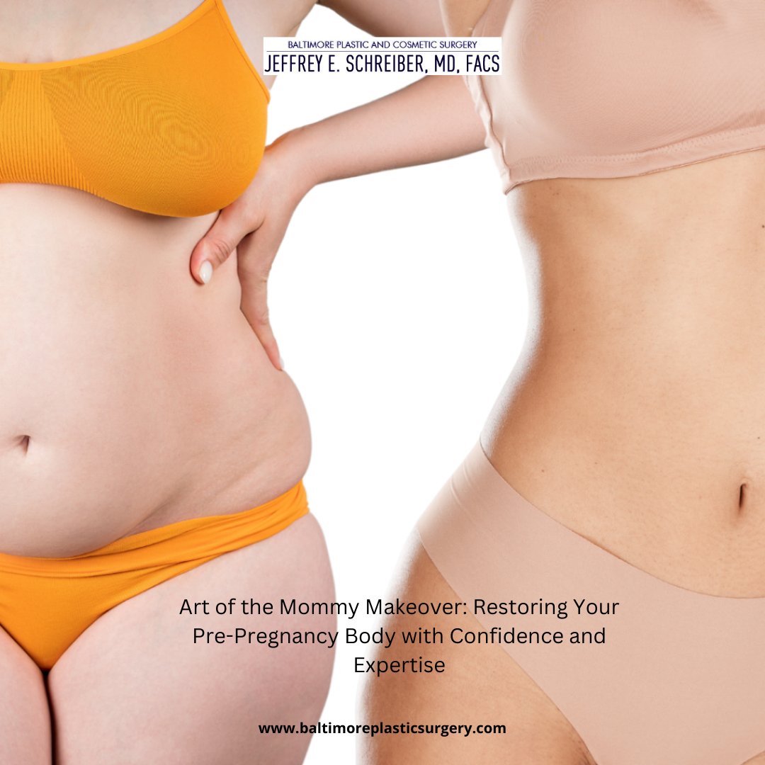 ePlasticSurgery's tweet photo. Embrace motherhood and rediscover confidence with a customized Mommy Makeover! https://t.co/dgbwSC6HBX

Ready to start? Call (410) 205-1846 for a consultation!

#MommyMakeover #BodyConfidence #PlasticSurgery https://t.co/dHHMfMKBmj